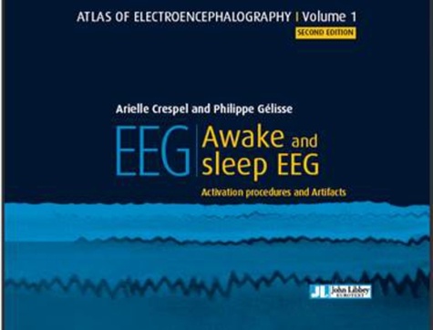 Philippe Gélisse et Arielle Crespel - Awake and sleep EEG - Volume 1, Activation procedures and artifacts.