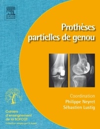 Philippe Neyret et Sébastien Lustig - Prothèses partielles du genou.