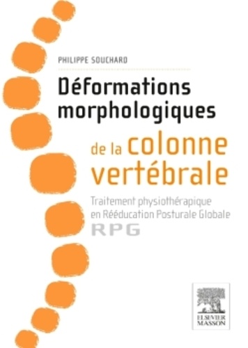 Déformations morphologiques de la colonne vertébrale : traitement physiothérapique en rééducation posturale globale - RPG