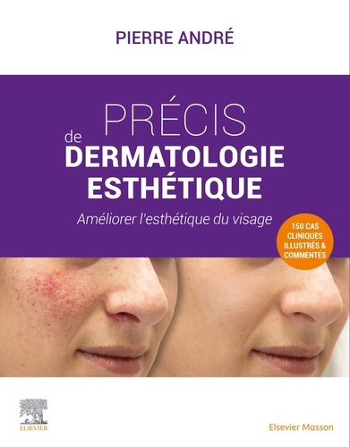 Précis de dermatologie esthétique. Améliorer l'esthétique du visage