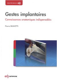 Pierre Bravetti - Gestes implantaires - Connaissances anatomiques indispensables.