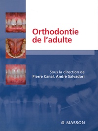 Orthodontie de ladulte - Rôle de lorthodontie dans la réhabilitation générale de ladulte.pdf