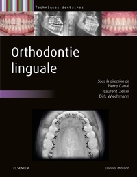 Pierre Canal et Laurent Delsol - Orthodontie linguale.