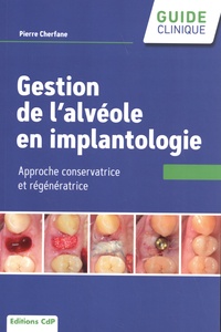 Pierre Cherfane - L'alvéole en implantologie - Approche conservatrice et régénératrice.