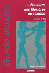 Pierre Chrestian et Benoit de Billy - Guide Illustre Des Fractures Des Membres De L'Enfant.