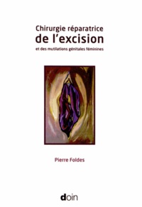 Coachingcorona.ch Chirurgie réparatrice de l'excision et des mutilations génitales féminines Image