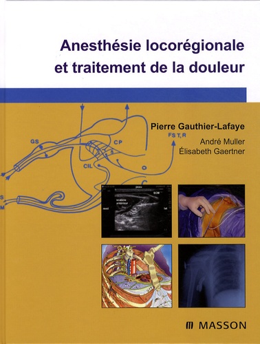 Pierre Gauthier-Lafaye - Anesthésie locorégionale et traitement de la douleur.