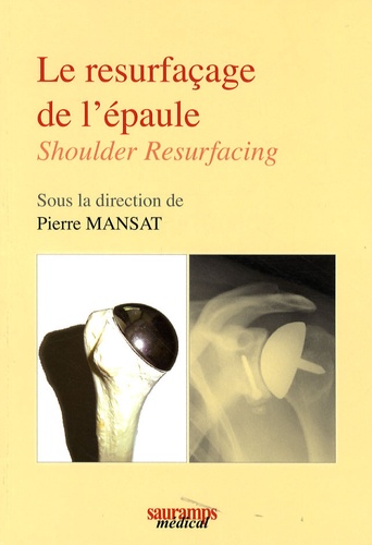 Pierre Mansat - Le resurfaçage de l'épaule - Shoulder Resurfacing.