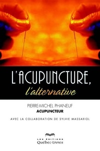 Lacupuncture, lalternative.pdf
