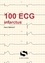 100 ECG infractus