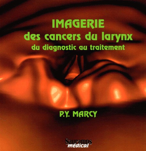 Pierre-Yves Marcy - Imagerie des cancers du larynx - Du diagnostic au traitement. 1 Cédérom