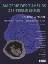 Imagerie des tumeurs des tissus mous
