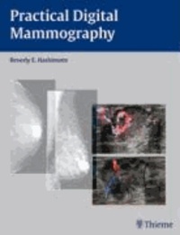 Practical Digital Mammography.