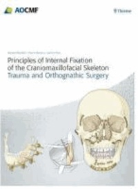Principles of Internal Fixation of the Craniomaxillofacial Skeleton - Trauma and Othognathic Surgery.