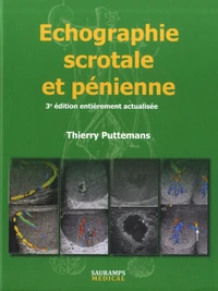 Echographie scrotale et pénienne