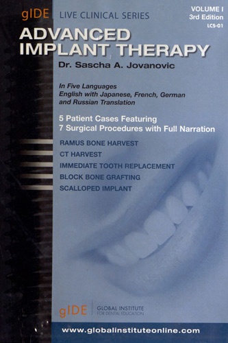 Sascha Jovanovic - Advanced Implant Therapy - Volume 1. 1 DVD