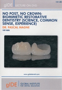 Pascal Magne - No Post, No Crown: Biomimetic Restorative Dentistry (Science, Common Sense, Experience). 1 DVD