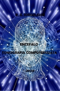  R.R. Iorgulescu - Encefalo - Tomografia Computerizzata.
