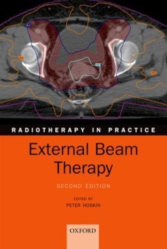 Radiotherapy in Practice - External Beam Therapy.