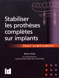 Stabiliser les prothèses complètes sur implants tout simplement