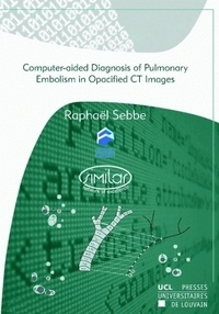 Raphaël Sebbe et  Similar - Computer-aided Diagnosis of Pulmonary Embolism in Opacified CT Images.