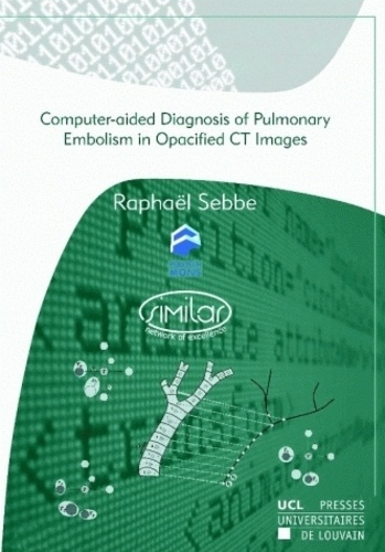 Computer-aided Diagnosis of Pulmonary Embolism in Opacified CT Images