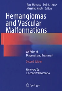 Hemangiomas and Vascular Malformations