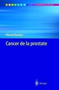 Cancer De La Prostate