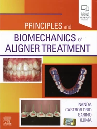 Principles and Biomechanics of Aligner Treatment