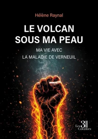 Le volcan sous ma peau