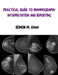 Practical Guide to Mammography Interpretation and Reporting