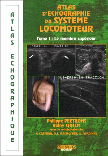 Rethy-K Chhem et Philippe Peetrons - Atlas D'Echographie Du Systeme Locomoteur. Tome 1, Le Membre Superieur.
