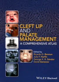 Cleft Lip and Palate Management: A Comprehensive Atlas