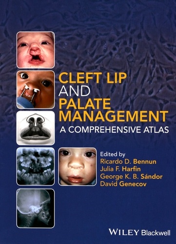 Ricardo Bennun et Julia Harfin - Cleft Lip and Palate Management: A Comprehensive Atlas.