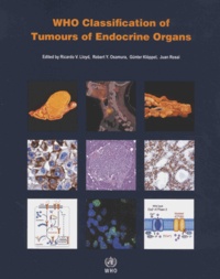 Ricardo V. Lloyd et Robert Y. Osamura - Who Classification of Tumours of Endocrine Organs.