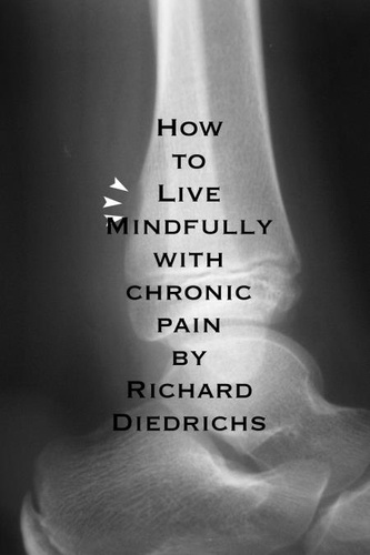  Richard Diedrichs - How to Live Mindfully with Chronic Pain.