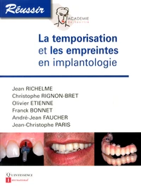 La temporisation et les empreintes en implantologie