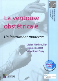 La ventouse obstétricale