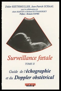 Surveillance foetale