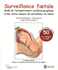 Surveillance foetale