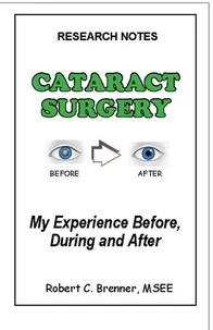 Cataract Surgery: My Experience Before, During and After