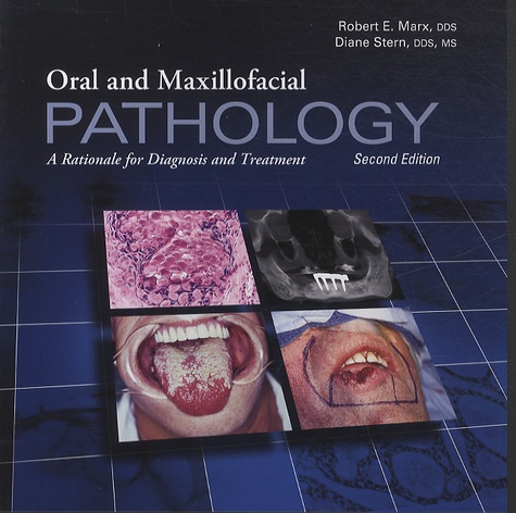 Robert E. Marx et Diane Stern - Oral and Maxillofacial Pathology in 2 volumes - A Rationale for Diagnosis and Treatment.