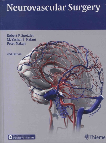 Neurovascular Surgery 2nd edition