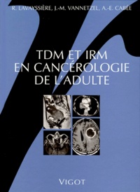 Robert Lavayssière et Jean-Michel Vannetzel - TDM et IRM en cancérologie de l'adulte.