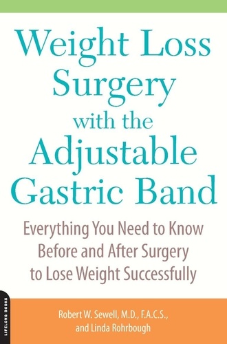 Weight Loss Surgery with the Adjustable Gastric Band. Everything You Need to Know Before and After Surgery to Lose Weight Successfully