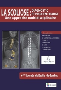 Robert-Yves Carlier et Christian Garreau de Loubresse - La scoliose : diagnostic et prise en charge - Une approche multidisciplinaire.