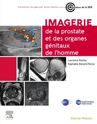 Imagerie de la prostate et des organes génitaux de l'homme