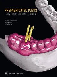 Prefabricated Posts