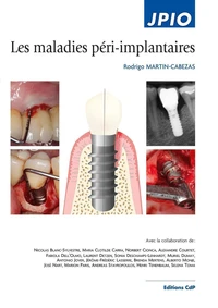 Les maladies péri-implantaire