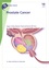 Prostate Cancer 10th edition